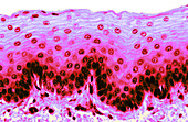 Esophageal epithelium,LM