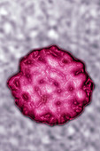 Norovirus,TEM