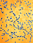 Bordetella pertussis bacteria,LM