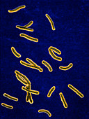 Mycobacterium tuberculosis bacteria,LM