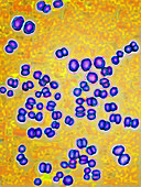 Neisseria meningitidis bacteria,LM