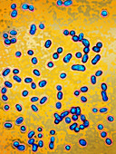 Streptococcus pneumoniae bacteria,LM