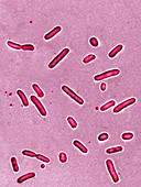 Pseudomonas aeruginosa bacteria,LM