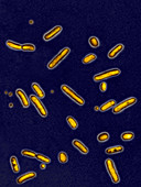 Pseudomonas aeruginosa bacteria,LM