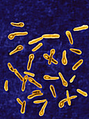 Tetanus bacteria,LM