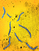 Treponema bacteria,LM