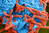 E. coli and Macrophage (SEM)
