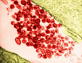 Human T-lymphotropic virus 1