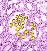 Novel H1N1 Virus,TEM