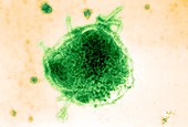 Measles and Simian Virus,TEM