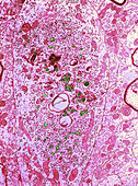 Group C RNA tumour virus particles,TEM