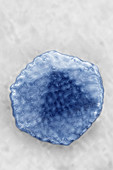 Hepatitis A Virus (HAV)