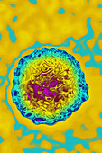 Hepatitis C Virus (HCV)