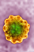 Hepatitis D Virus (HDV)