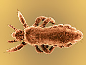 Human Head Louse,SEM