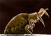 Human Body Louse (SEM)