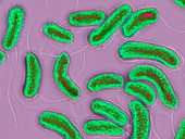 Vibrio Cholera Bacilli,LM