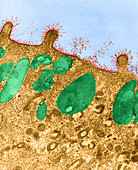 Cell Membrane,TEM