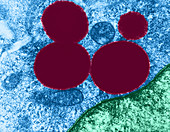 Lipid Droplets,TEM
