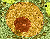 Thale Cress,Root Tip Cell Nucleus,TEM