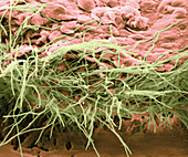 Hyphae on Human Skin,SEM