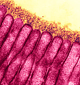 Microvilli,TEM