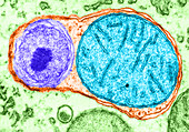 Autophagic Vacuole (TEM)