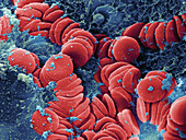 Human Red Blood Cells,SEM