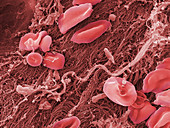 Blood Platelets and Red Blood Cell,SEM