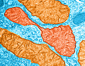 Dividing Mitochondrion,Liver Cell TEM