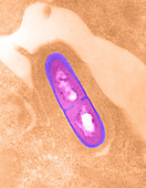 Listeria bacterium