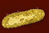 E. coli Infected with Bacteriophage,TEM