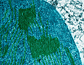 Chloroplasts in Tomato Leaf Cell,TEM