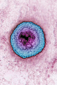 Varicella zoster virus,TEM