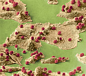 Immune Cells Attacking Cancer Cells,SEM