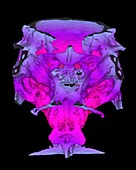 Zebrafish skull,3D micro-CT scan