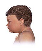 Normal head size in newborn,illustration