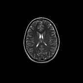 Teenage brain,MRI scan