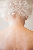 Elderly woman's neck and upper back