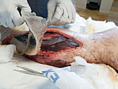 Woundcare for compartment syndrome