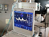Cardiac ultrasound scanner