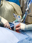 Tracheostomy ventilation tube