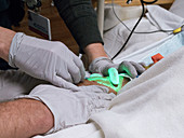 Nurse using infrared vein-finding device