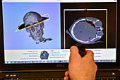 Forensics 3D virtual autopsy