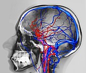 Normal brain blood supply,CT scan