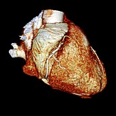 Normal coronary artery,3D CT scan