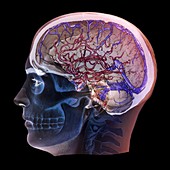 Normal brain blood supply,3D CT scan