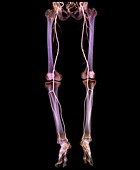 Normal leg blood vessels,3D CT scan