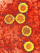 Epstein-Barr virus particles,TEM