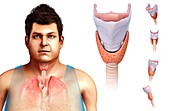 Human thyroid cartilage,illustration